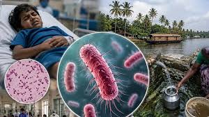 Shigella outbreak in Kerala